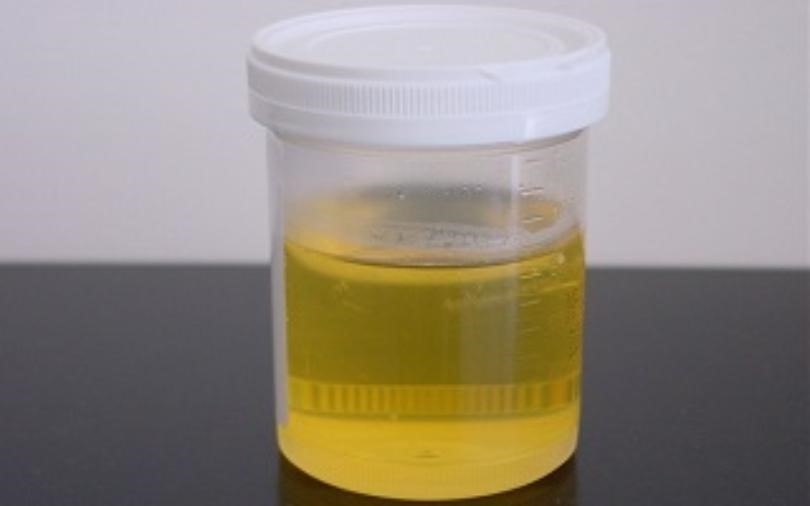 Synthetic Urine 
      Quick Fix Reviews Ridge Crossing Concord NC
